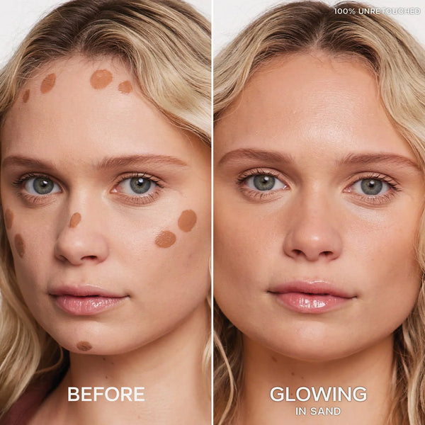 Dew Bronze™ Duo